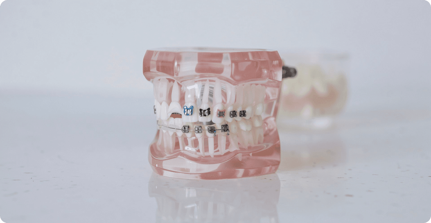 Orthodontic treatment Vancouver