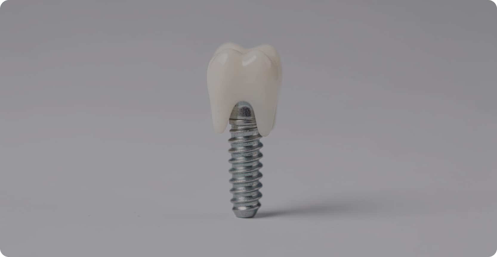 Dental Implants Vancouver